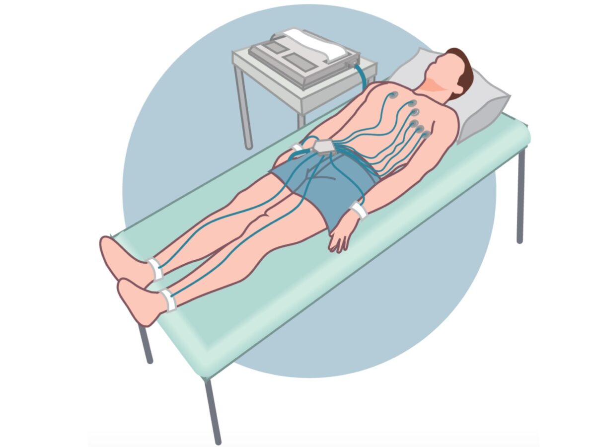 Electrocardiograma